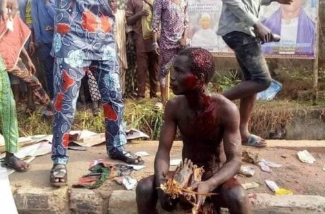 Suspected ritualist caught with human parts beaten mercilessly
