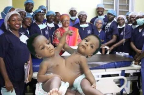 Nigerian Doctors Who Seperated Conjoined Twins Set to be Honored