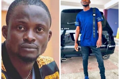 How Nollywood Actor, Jigan Rejected A Free Corrective Surgery On His Leg Because It Brought Him Fame