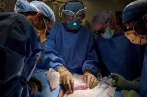 Surgeons Successfully Test Pig Kidney Transplant In Human Patient