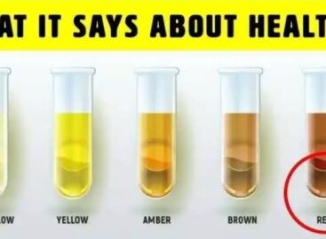 What The Colour Of Your Urine Says About Your Health