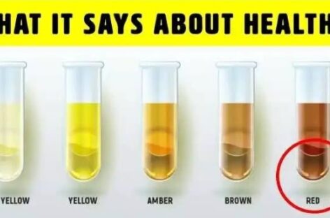 What The Colour Of Your Urine Says About Your Health