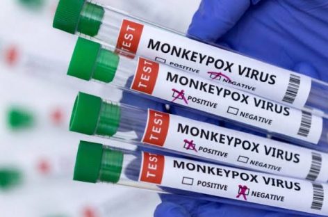 Health Minister says no confirmed cases of monkeypox in Japan
